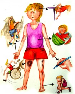 drawforjoy' collection of scars